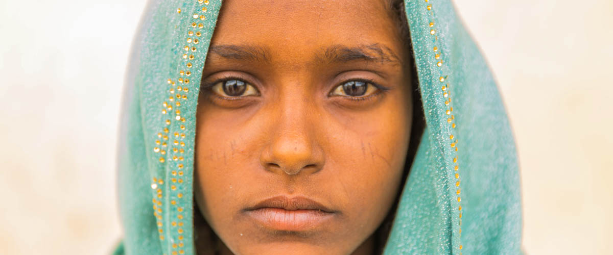 接受了女性生殖器切割的14岁埃塞俄比亚女童阿伊莎。儿基会埃塞俄比亚办事处图片/ 2017 / Mersha
